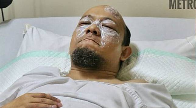 Kondisi Novel Baswedan Saat Dijenguk Ketua KPK dan Kapolda Metro Jaya- AFP Photo-spripimpoldametro-20170411