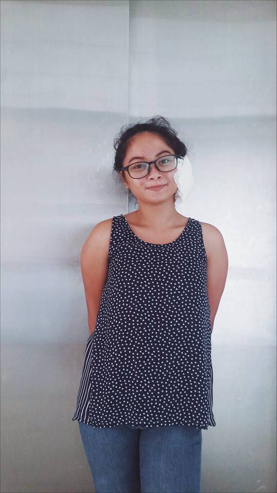 Hati-hati! Pakai Anting Harga Rp.15 Ribu, Cewek Ini Harus Alami Nasib Mengerikan, Lihat Telinganya!