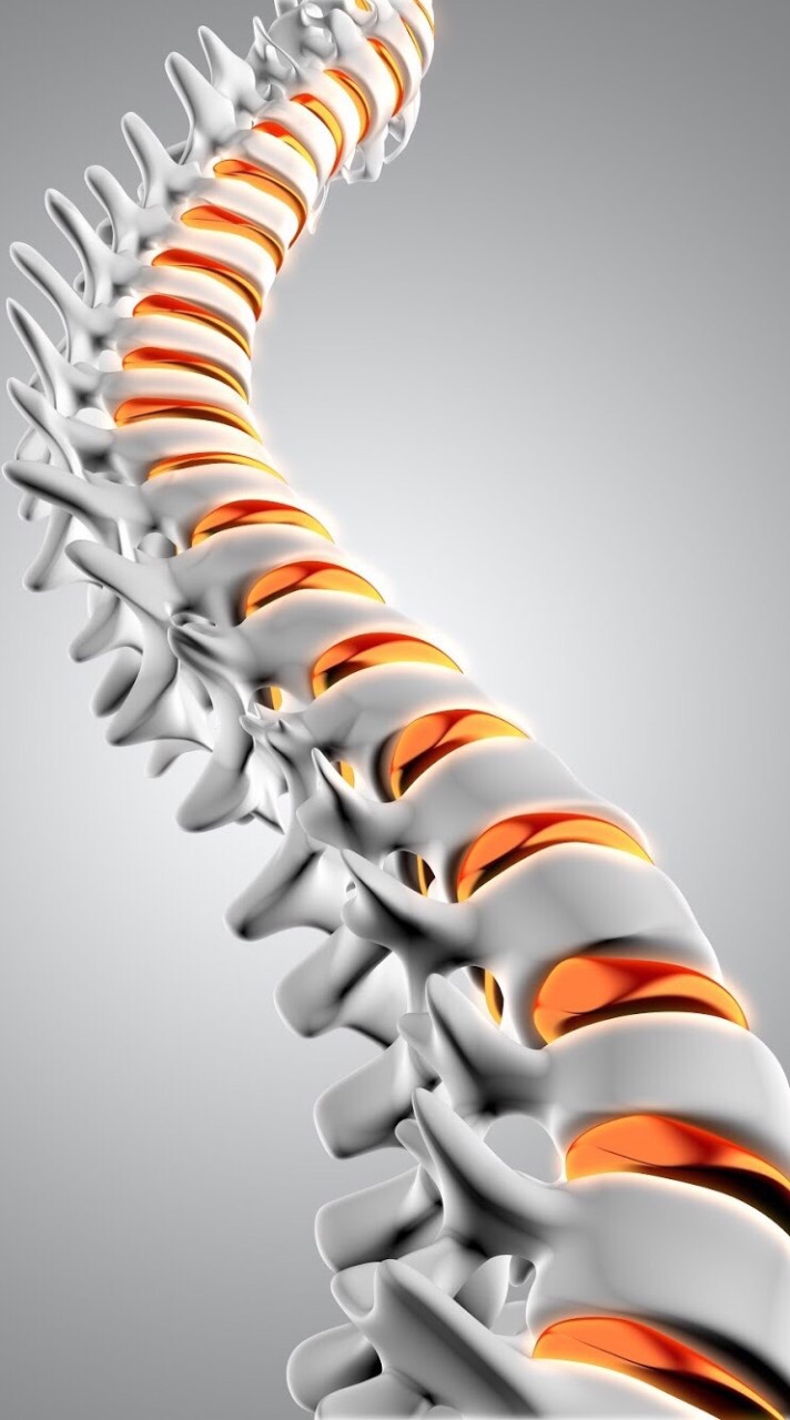 กระดูกสันหลังคด Scoliosis
