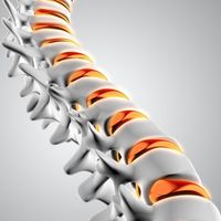 กระดูกสันหลังคด Scoliosis