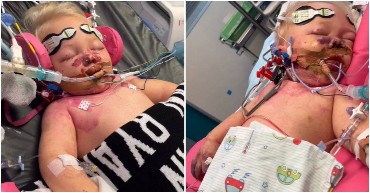 Australian Baby’s Fight Against Sepsis: A Warning for Parents