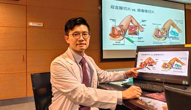 融合導引攝護腺切片 成大醫引進新技術 磁振造影 超音波 勁報 Line Today