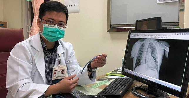 肋骨骨折傳統治療需忍痛新式肋骨固定術復原快 Nownews 今日新聞 Line Today