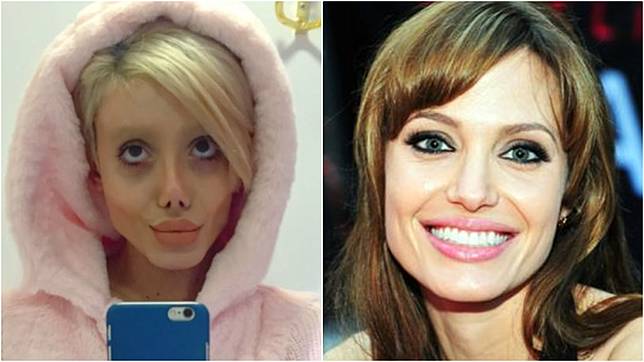 Wanita di Iran Operasi Wajah 50 Kali Supaya Mirip Angelina  
