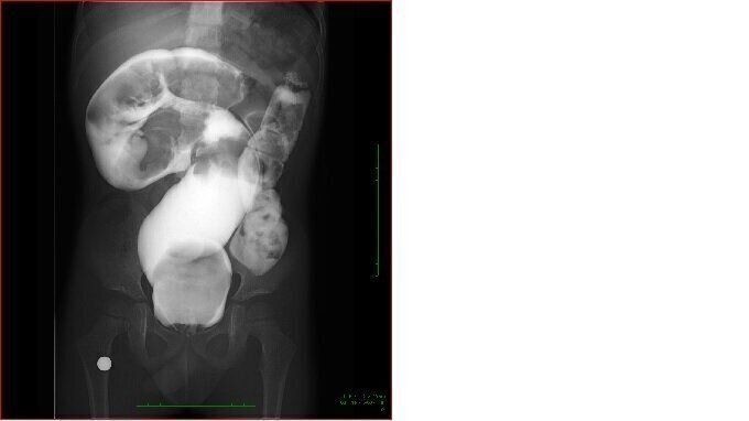 セリアで見つけた おしゃれカワイイ注目ポーチ4選