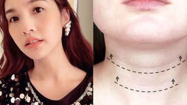 楊丞琳：女人臉再年輕都沒用，一條頸紋就超顯老！「認真擦防曬＋頸部伸展運動」9招消除頸紋保養，請筆記