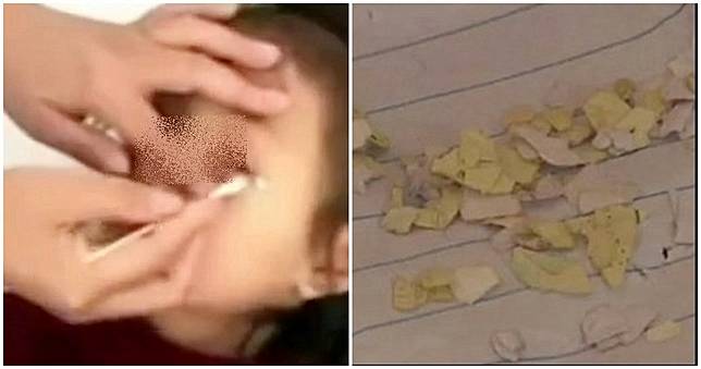 3同學架住「紙片塞眼」霸凌！小二女童恐瞎　校長：在玩沒惡意