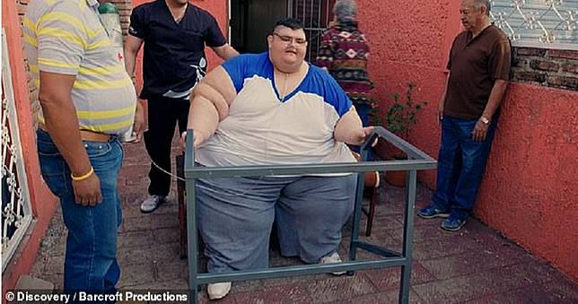 590kg世界上最胖男子！「縮胃、節食」成功甩330kg