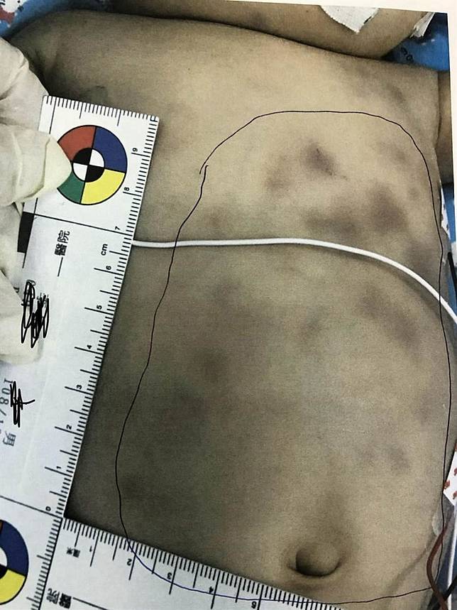 痛毆1月大男嬰，生父被訴