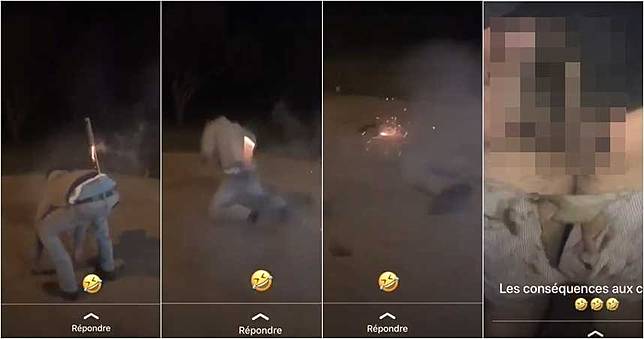 影／屁股夾太緊…沖天炮飛不出　蠢男「爆菊」屁股全炸黑