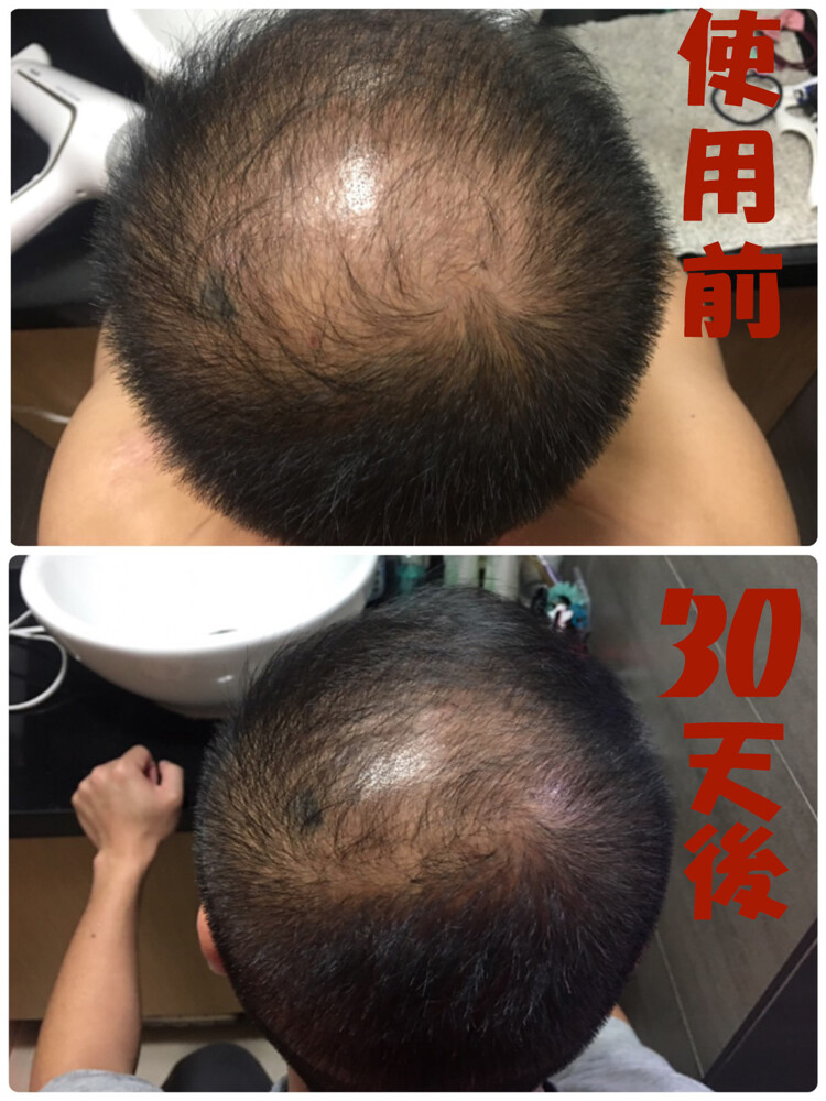 So Natural草本髮根營養液（生髮水） 不含雌激素（Estradiol」（雌二醇）、「Estrone」（雌固酮），以及「Ethinylestradiol」（乙炔雌二醇）三種雌激素），完全使用天然