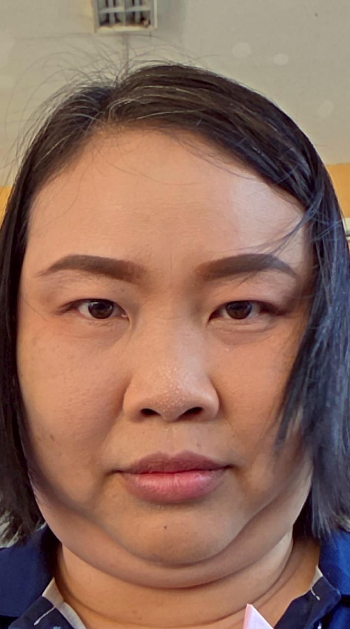 รด 69