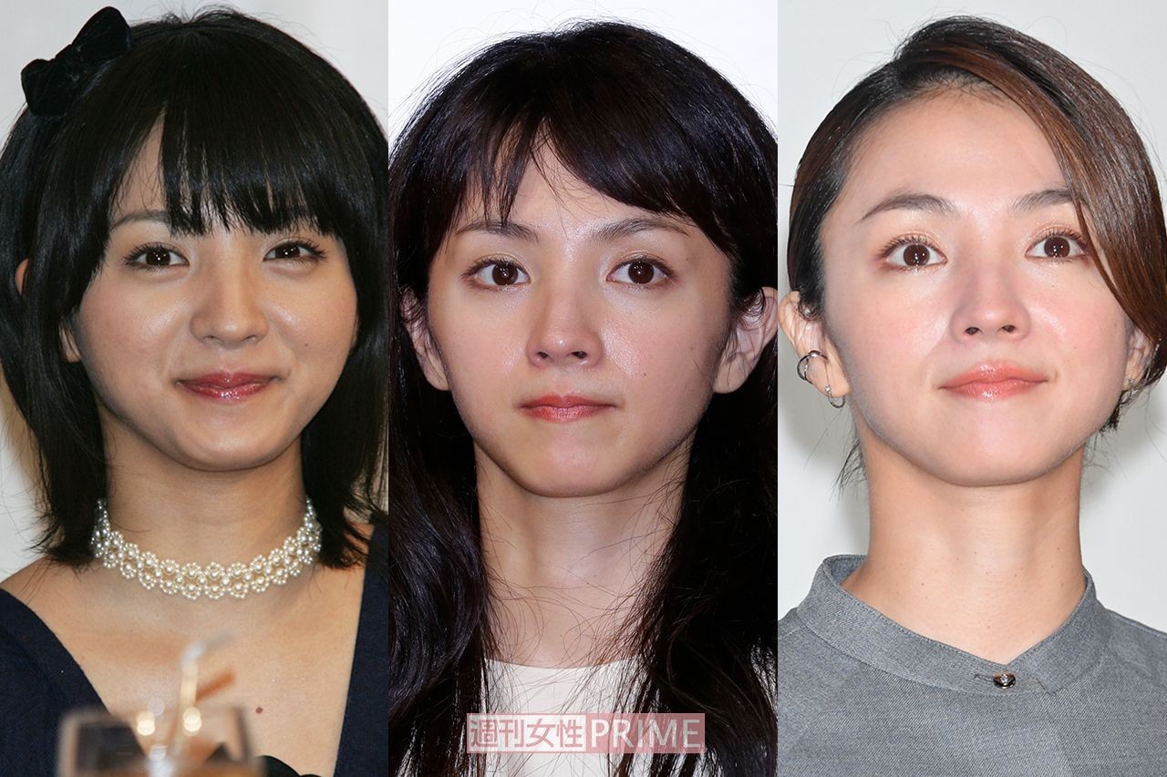 綾瀬はるか 上戸彩 蒼井優ら 年女 女優を美容外科医が格付け 週刊女性prime