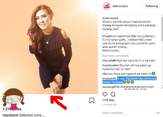 Lihat Foto Rey Utami Ini, Paha dan Jari Kelingkingnya Lenyap