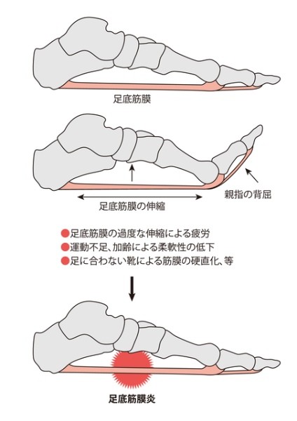 違う 体温 左右