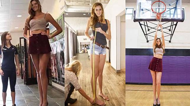 Gadis 22 Tahun Ini Punya Kaki Terpanjang, Namun Ini yang Membuatnya Susah
