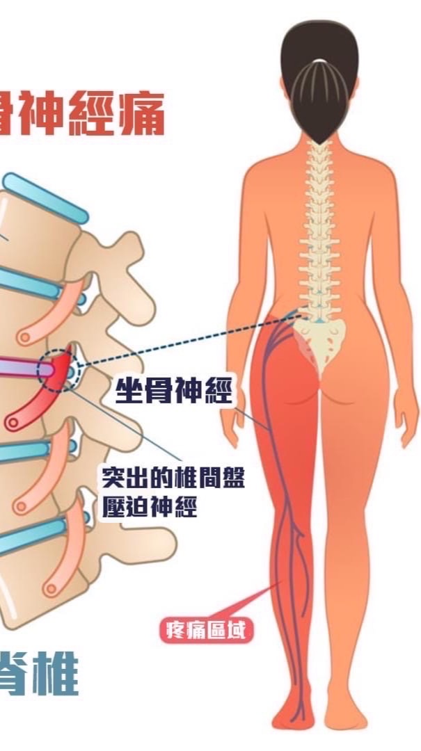 脊椎健康社群