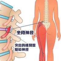 脊椎健康社群