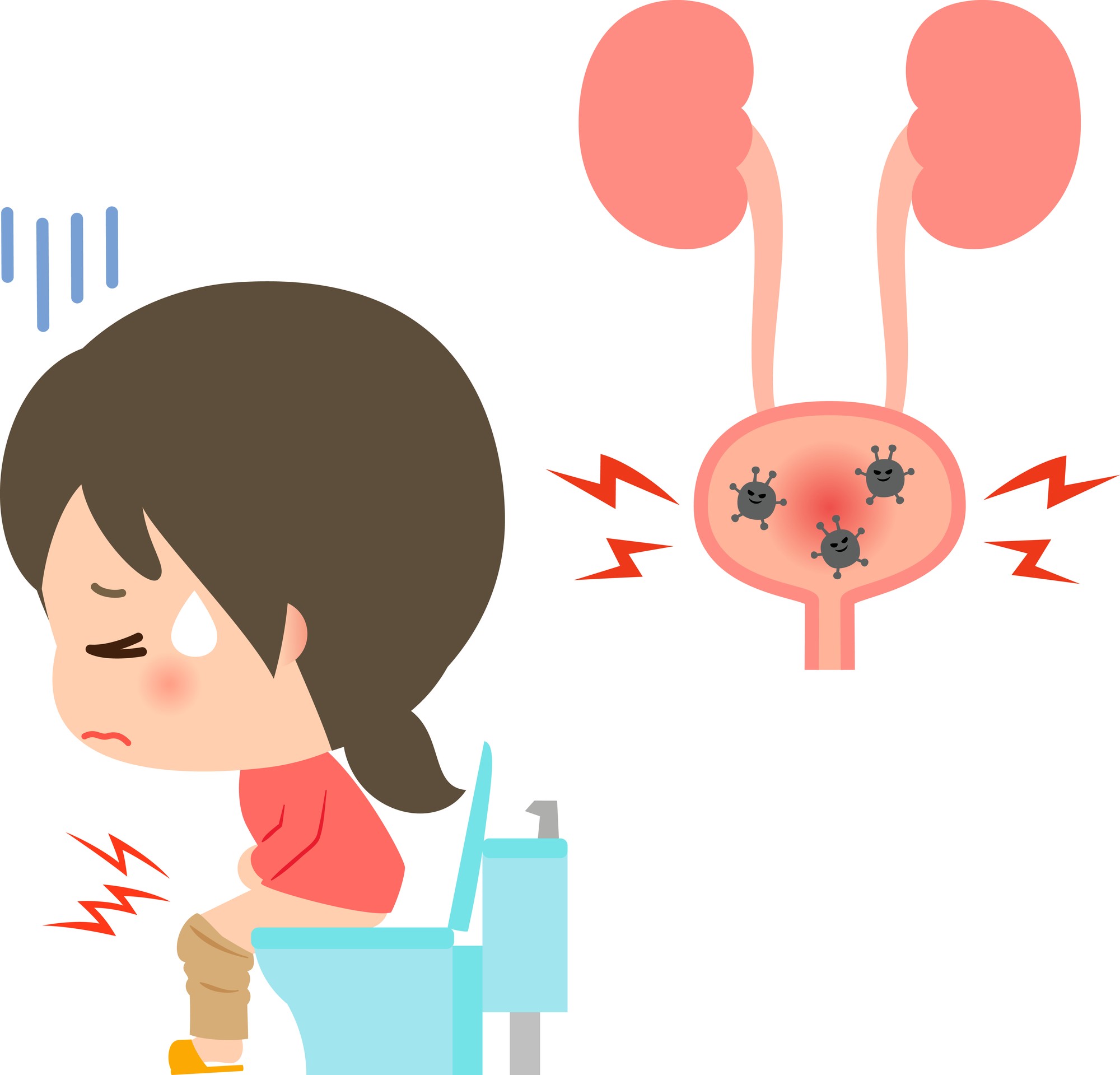 女性に多い膀胱炎 その症状と治し方 予防方法とは
