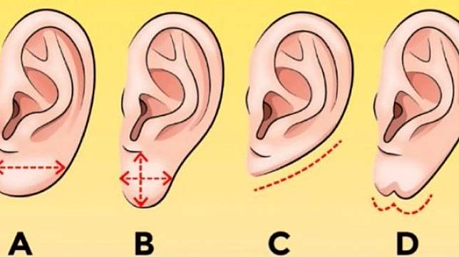 Tes Kepribadian Bentuk Telinga Ungkap Karakter Anda Yang Mana Suara Com Line Today