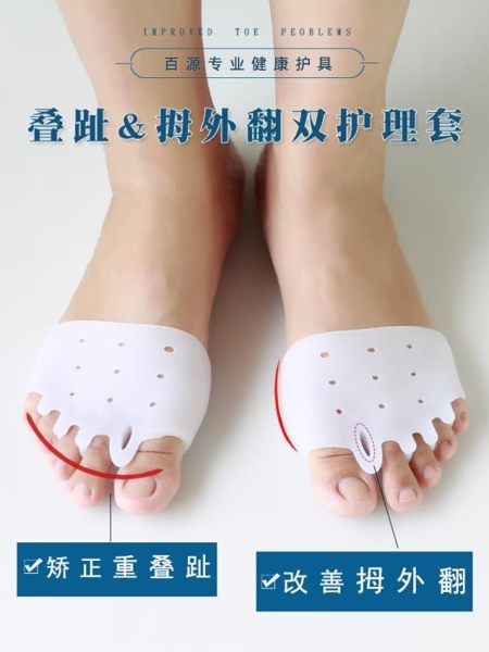 分趾器 重疊趾錯趾拇外翻雙護理套男女分趾腳趾腳指套五孔固定舒適矯正器 moon衣櫥