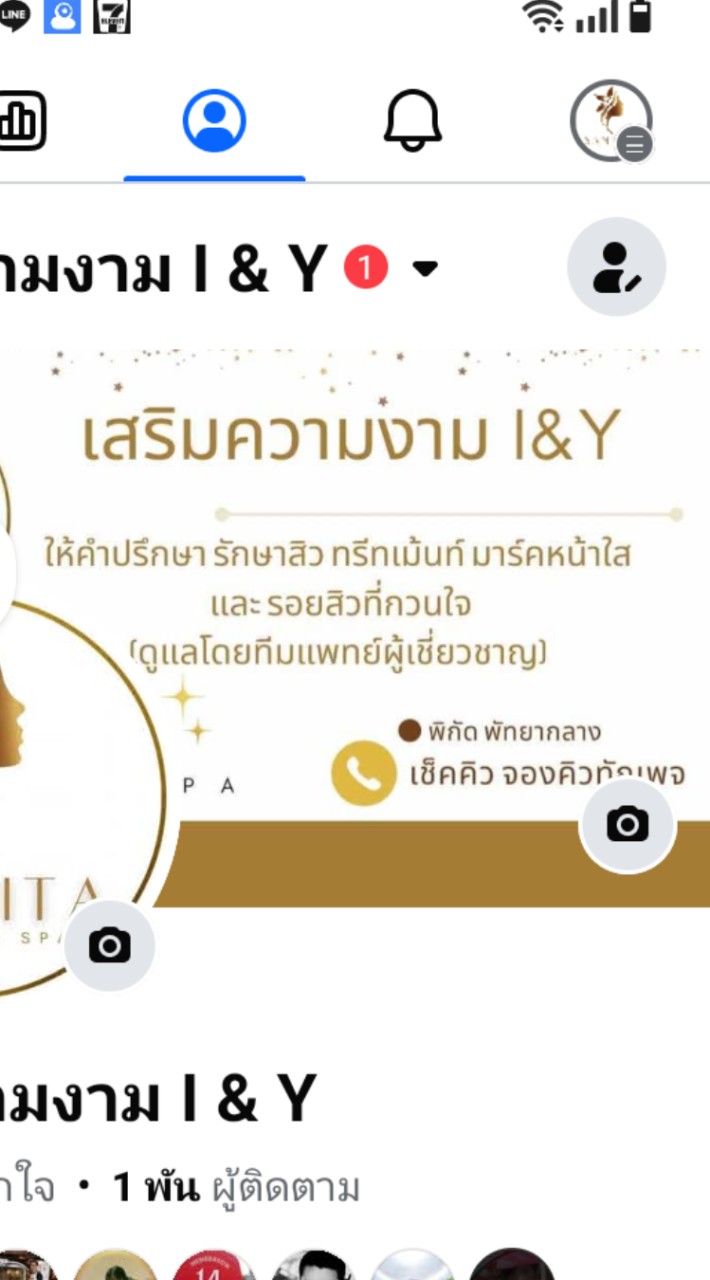 📍เสริมความงาม I&Y