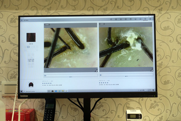 台北頭皮護理，台北頭皮養護spa-WT Methode美絲得，源自韓國的台北專業頭皮養護，給頭皮極致享受的大直頭皮護理中心