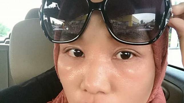 Derita Nur Sakinah, Bukan Tambah Cantik Usai Pakai Eyeshadow, Matanya Berubah Mengerikan Seperti Ini