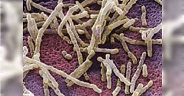 【糞便救命1】合格黃金需5條件　女兒捐屎救老父