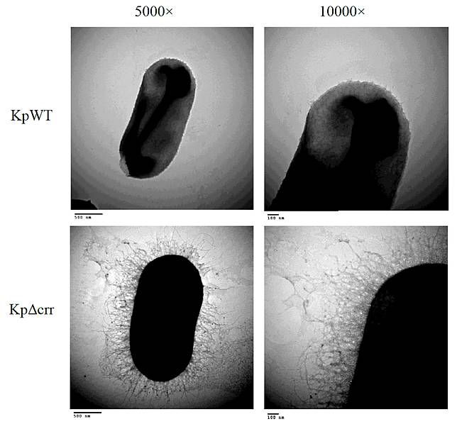 慈大蘇伯琦研究克雷伯氏肺炎桿菌與肝膿瘍關係 Tcnews 慈善新聞網 Line Today