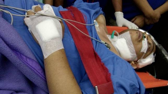 Kondisi Hermansyah Usai Jalani Operasi di RS Hermina Depok