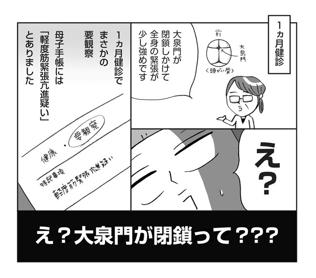 え 頭の大泉門が閉鎖 1カ月健診で軽度筋緊張亢進疑いと診断されて