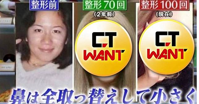 40歲大媽整形百次變真人芭比　「恐怖後遺症」驚呆眾人