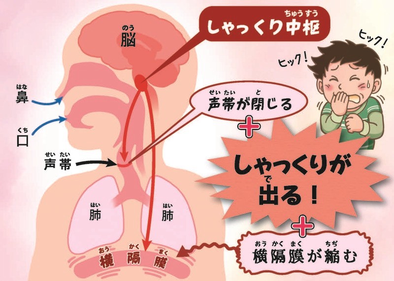 疑問解決 なるほどね しゃっくり なぜ出るの 朝日学生新聞社