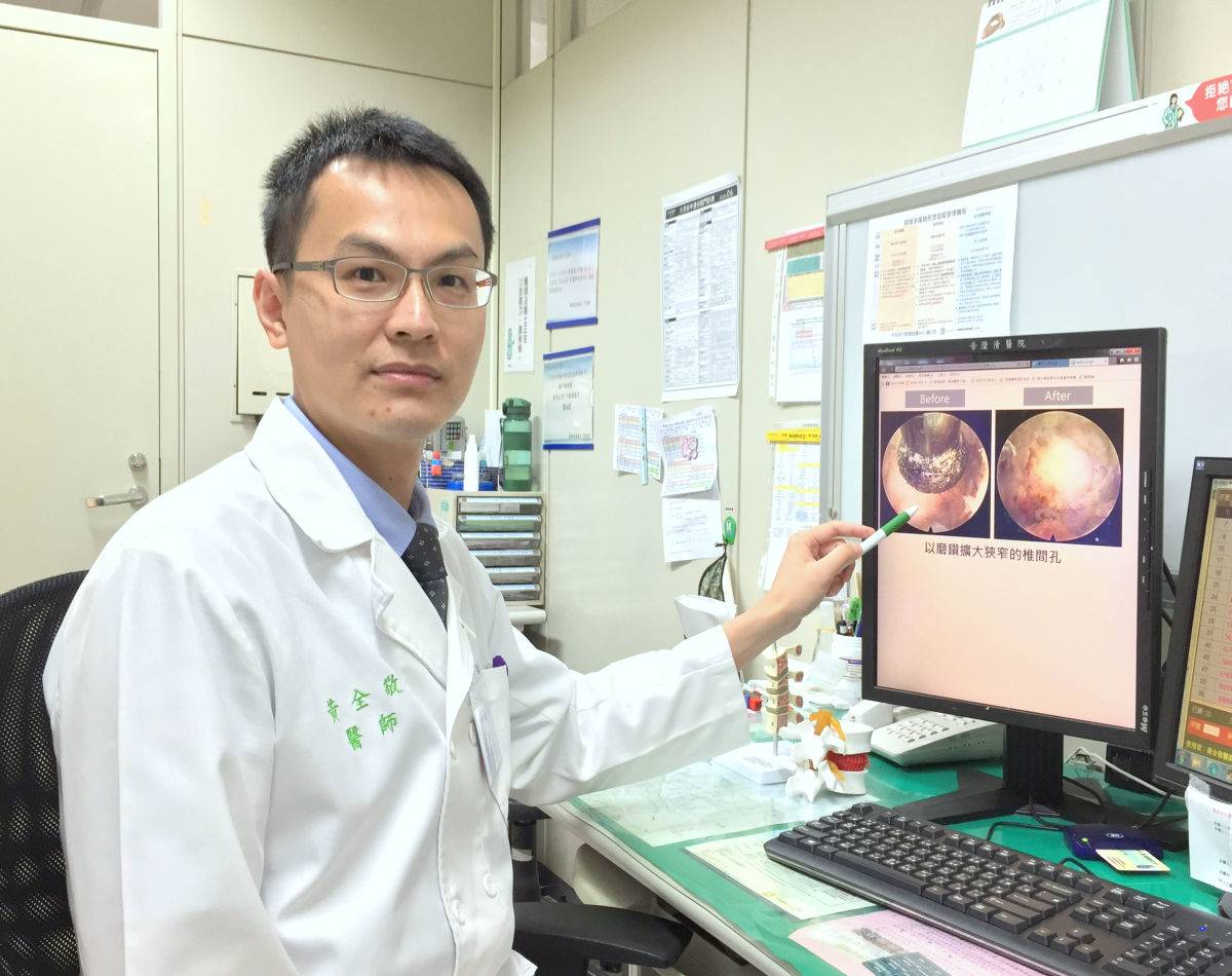 閃到腰查出椎間孔狹窄骨刺增生微創脊椎內視鏡手術改善 中廣新聞網 Line Today