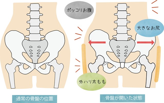 なぜ年齢を重ねるほどぽっこりお腹になる 医師が解説します