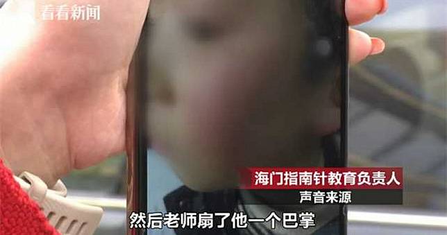 21天有17天被打　江蘇男童臉滲血「牙齒被打鬆」