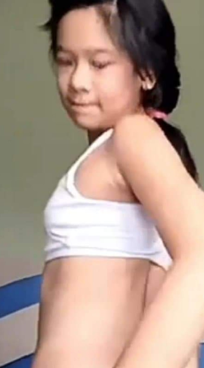10YOc