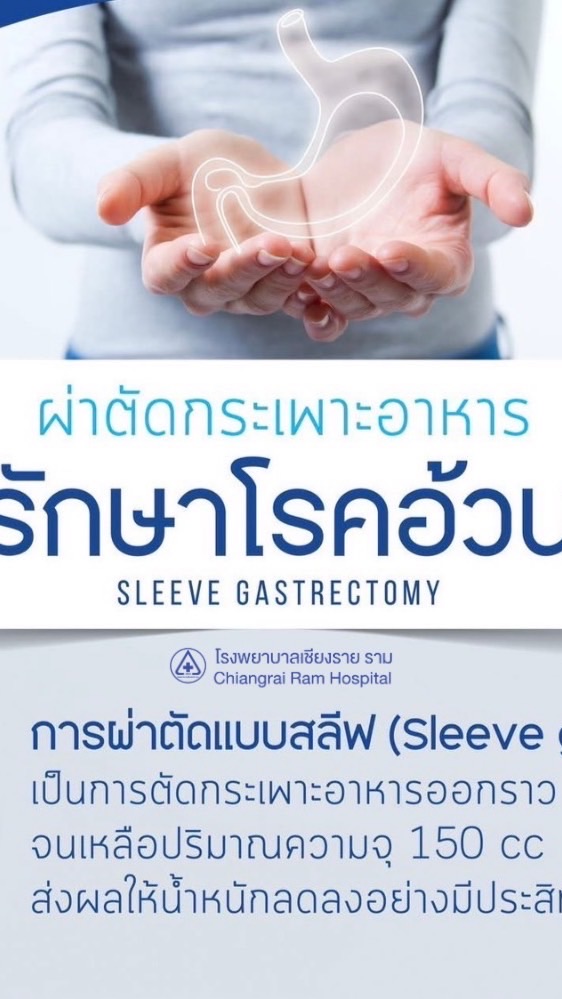 แชร์ปสก. ผ่าตัดกระเพาะลดอ้วนกับ เชียงราย ราม CRR