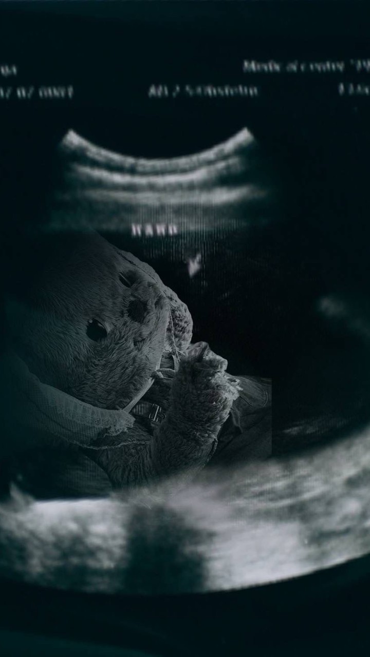 สายรหัสทับแปด 1/8 2/8 👩🏻‍❤️‍💋‍👩🏻