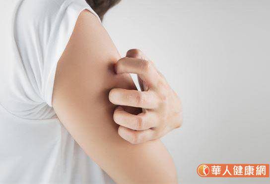 毛囊角化症上身 手臂 大腿出現大片紅疹 做對這2件事助改善 華人健康網 Line Today