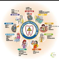 [関西]CEAP(シープ)患者の広場