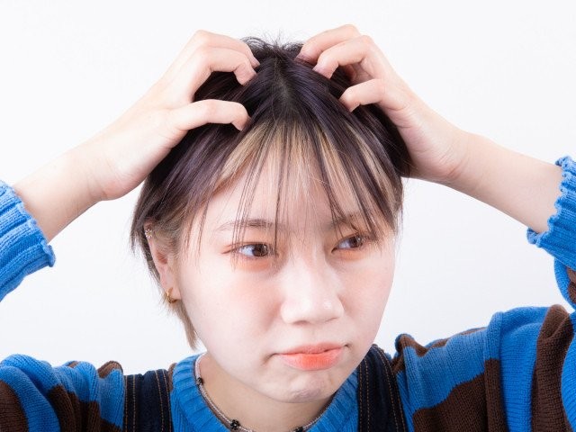 頭皮がかゆくてフケも気になる 原因を見極めて対処せよ 髪のプロが指南 ヘアのお悩み一問一答 美的news