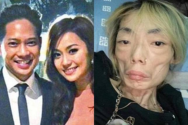 Kondisi artis Wu Zhiheng dulu dan sekarang