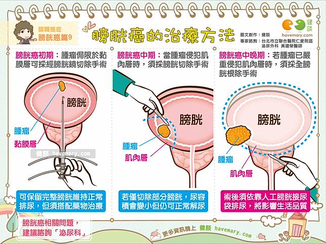 膀胱癌的治療方法 認識癌症膀胱癌篇9 健談網 Line Today