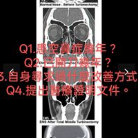 空鼻症患者