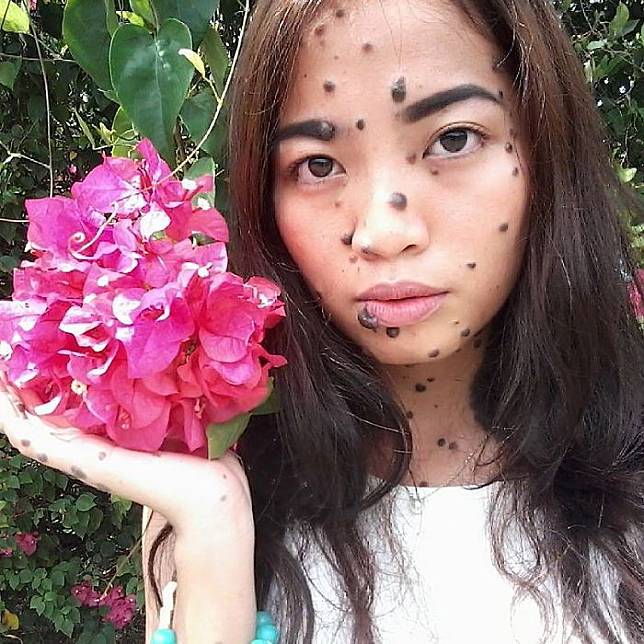 Viral, Wanita Cantik dengan Tahi Lalat di Sekujur Tubuh Ini Mungkin Jadi Miss Universe Malaysia!