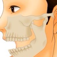 顎関節症　不定愁訴