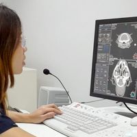 นัด CT scan KU KPS