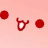 通常型オプ